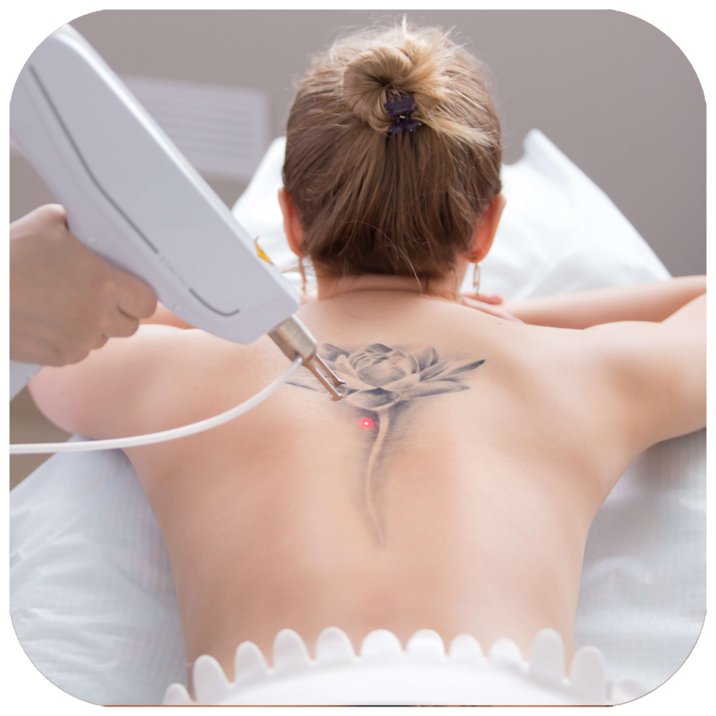 Laser Hair & Tattoo Removal Terwillegar Massage